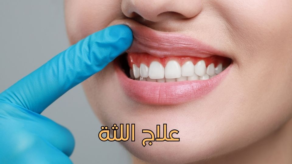 علاج العصب (قناة الجذر)-2