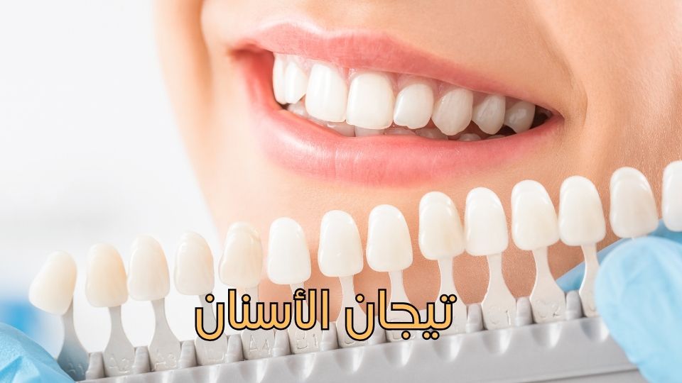 علاج العصب (قناة الجذر)-3