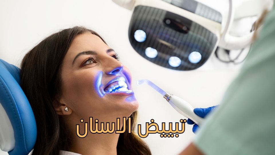 علاج العصب (قناة الجذر)